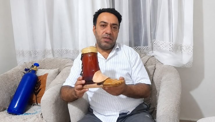 İş isteyen engelli vatandaş: “5 bin lirayla geçinemiyorum, protezimi koli bandıyla tamir ettim”